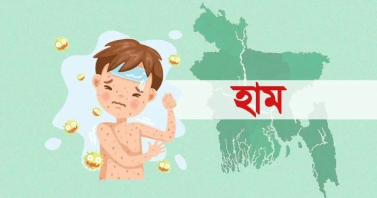 সিলেটে হামে আরো দুই শিশুর মৃত্যু, দুইদিনে মারা গেলো ৫ জন