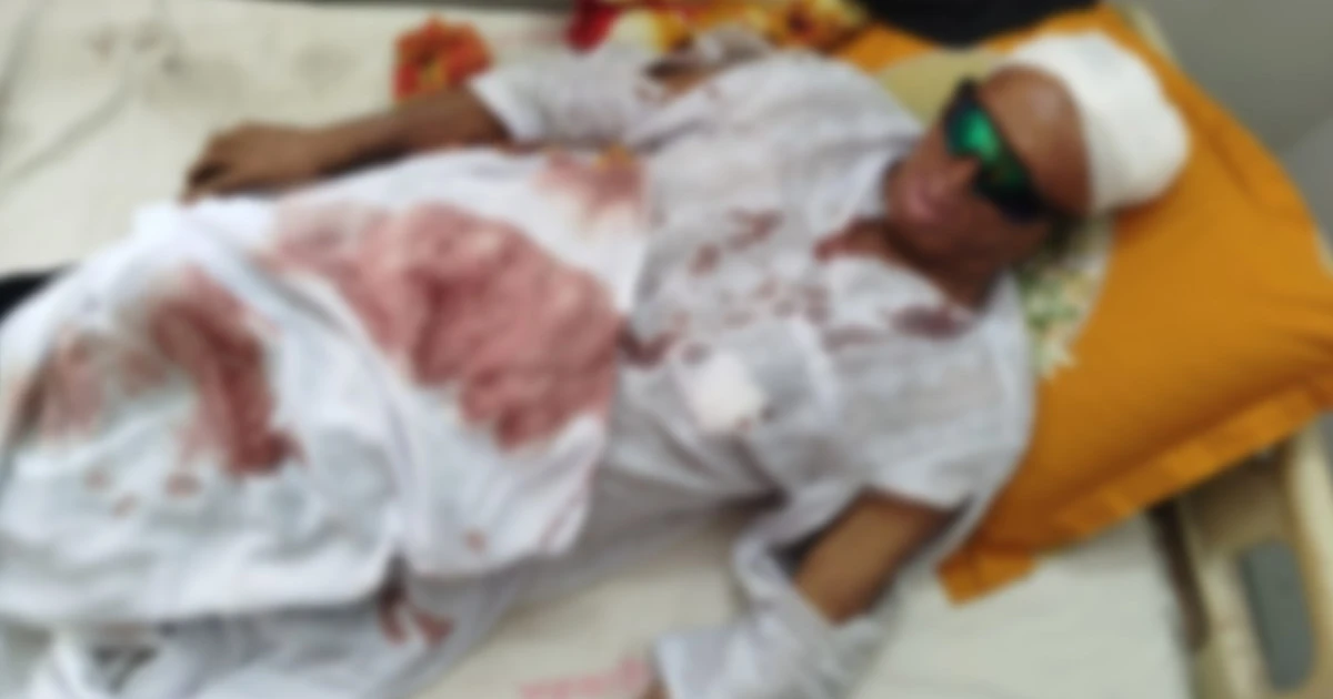 স্ত্রীর নিদের্শে স্বামীর উপর হামলা; হাসপাতালে ভর্তি