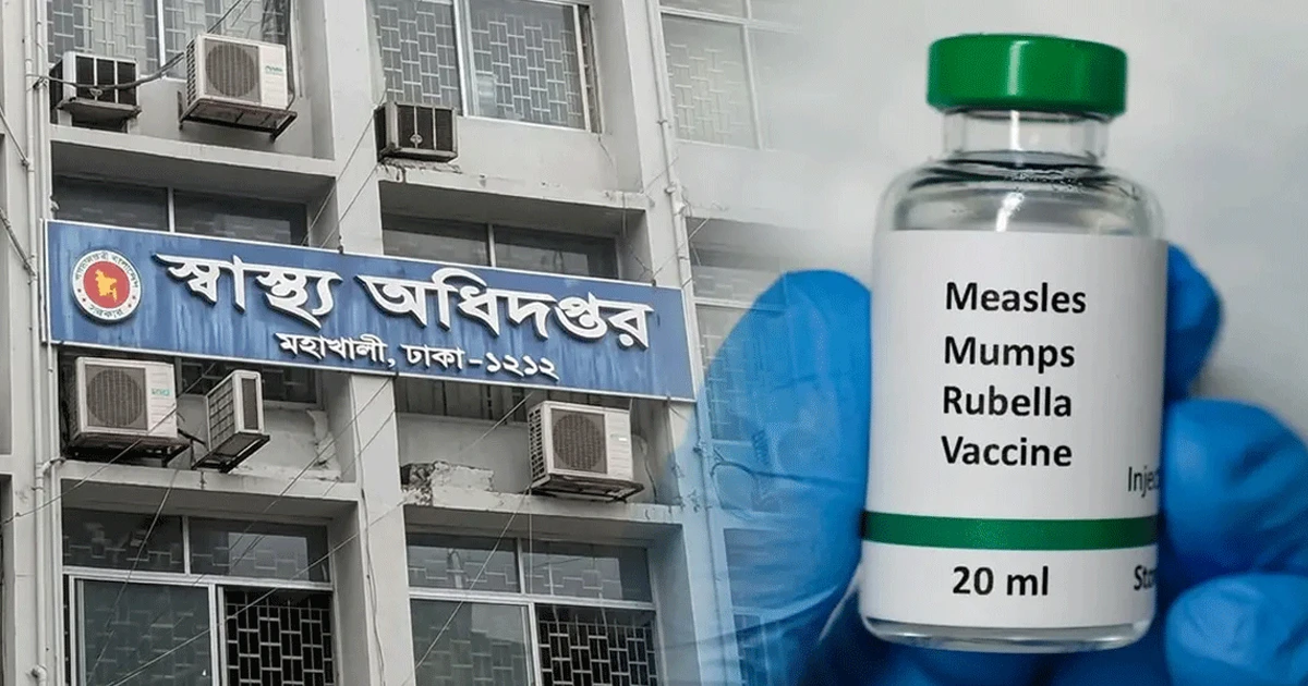হাম ও উপসর্গ নিয়ে মৃত্যু ৪০০ ছাড়াল