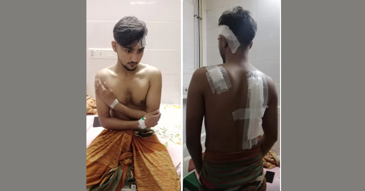 গাজীপুরে সন্ত্রাসী হামলায় আহত কিশোর