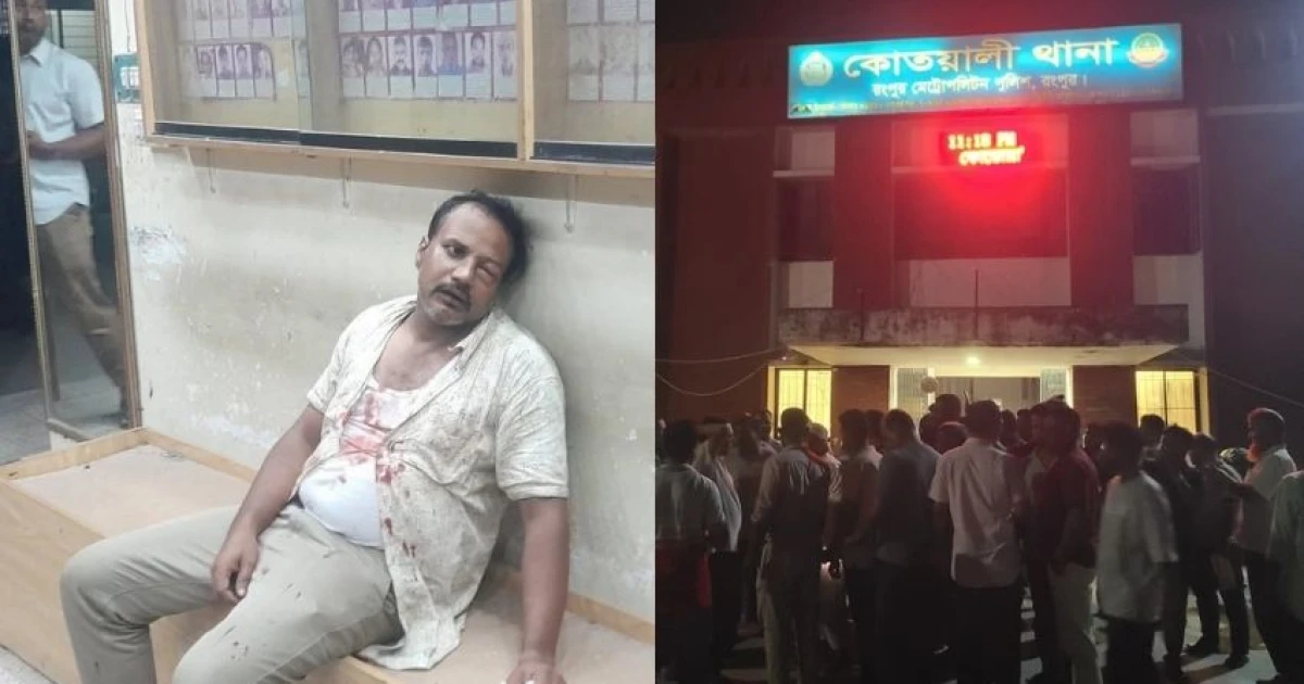 রংপুরে স্বেচ্ছাসেবক দল নেতাকে থানায় মারধর, ওসিসহ ৫ পুলিশ সদস্য ক্লোজড