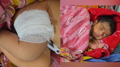 কলাপাড়ায় থেরাপি দিতে গিয়ে নবজাতকের পা ভাঙলেন নার্স