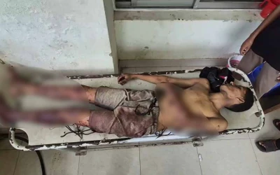 বাঞ্ছারামপুরে আধিপত্যের বিরোধে রাতভর সংঘর্ষ, নিহত ১; আহত ২৫